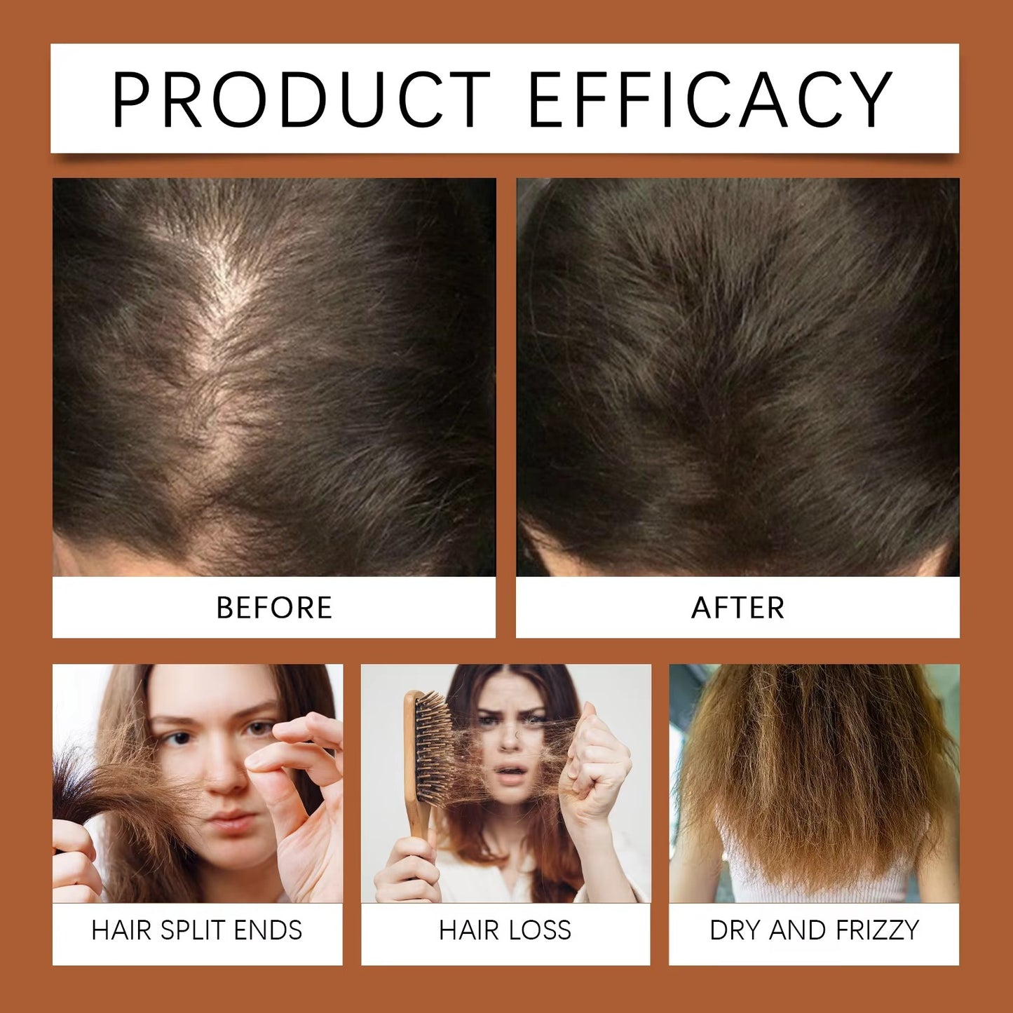 Rosemary Castor Oil – Hair & Scalp Treatment for Dry, Damaged, Frizzy Hair